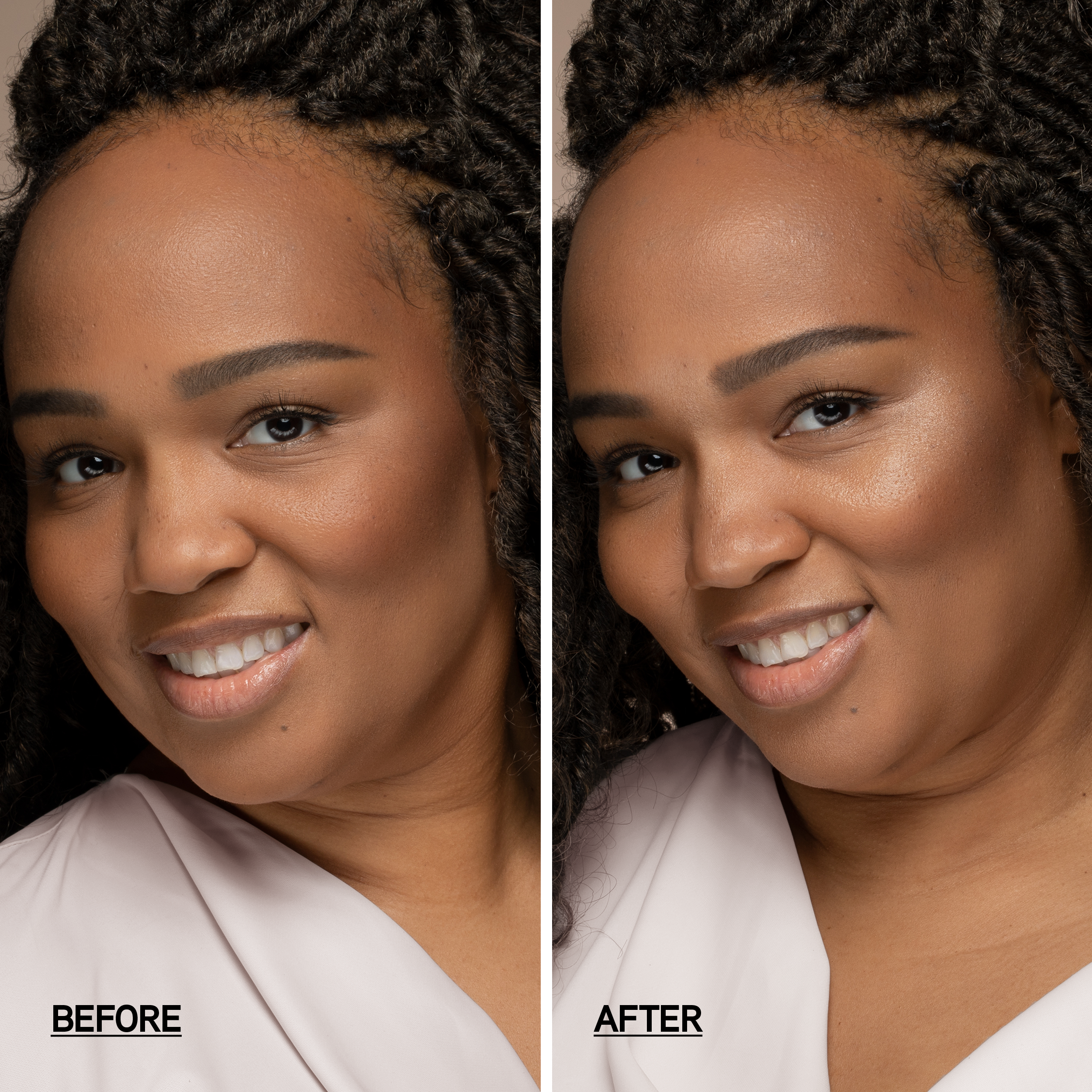 1712791_4_Before-After.png
