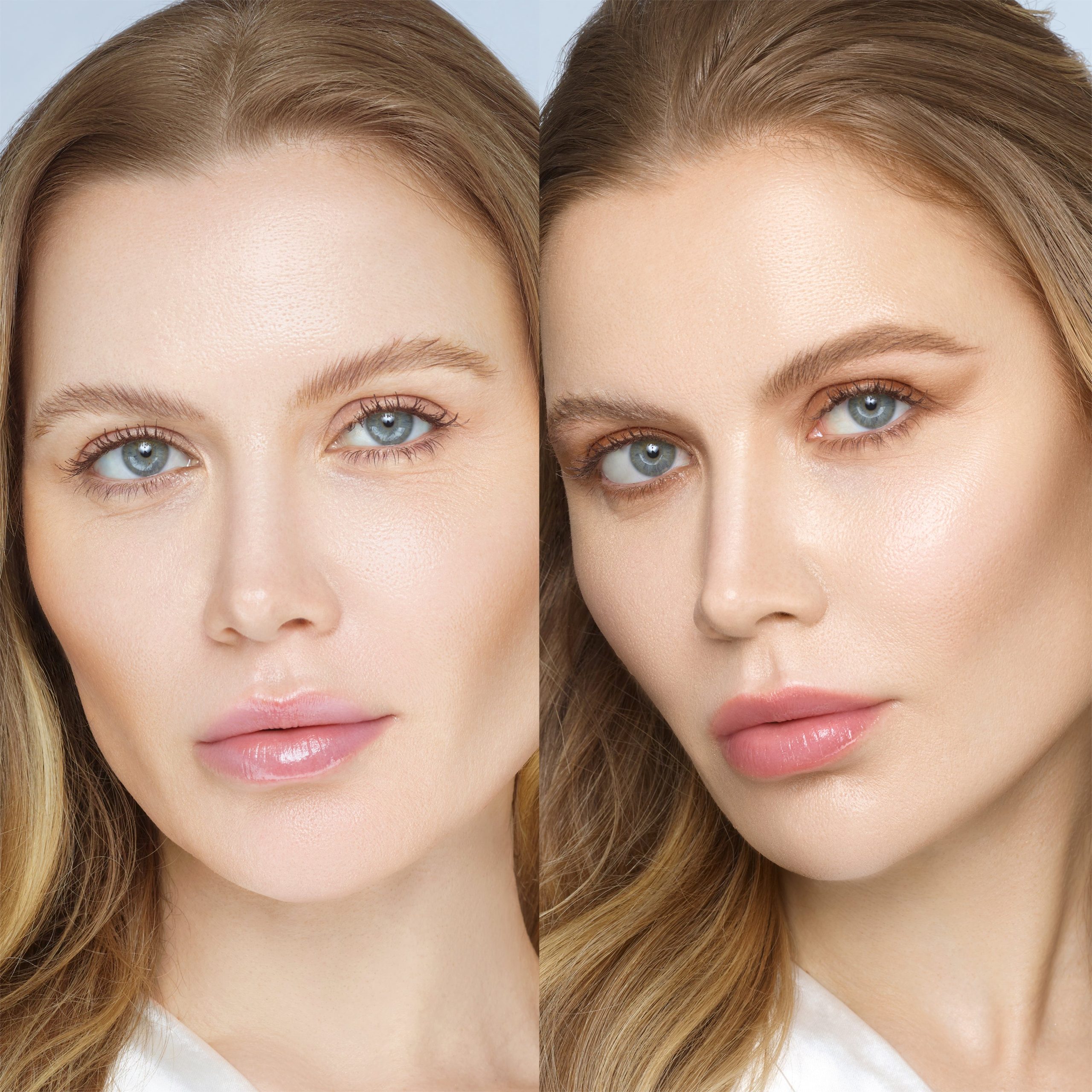 EB_EyeLifter_Before_After.jpg